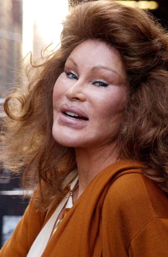 Jocelyn Wildenstein in Photos: Pictures of ‘Catwoman’ Over the Years